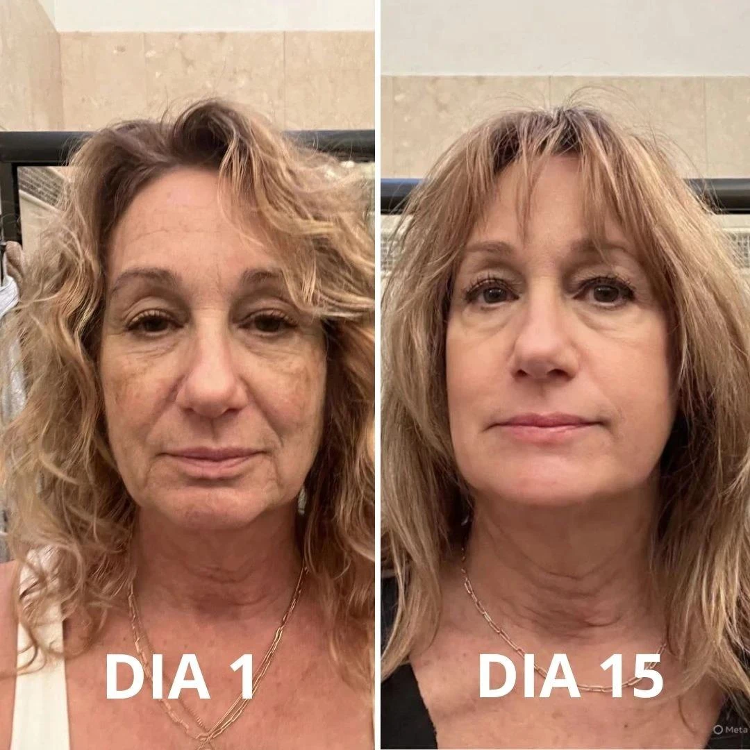 Descrição da imagem