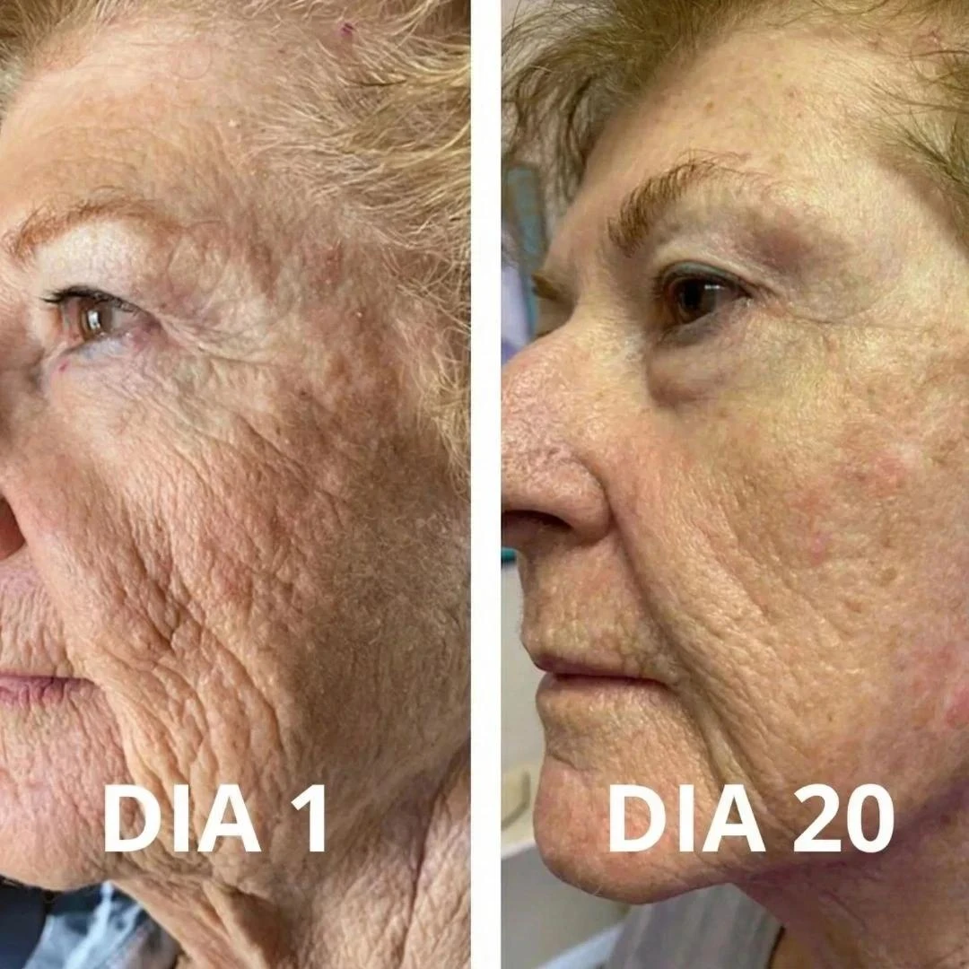 Descrição da imagem