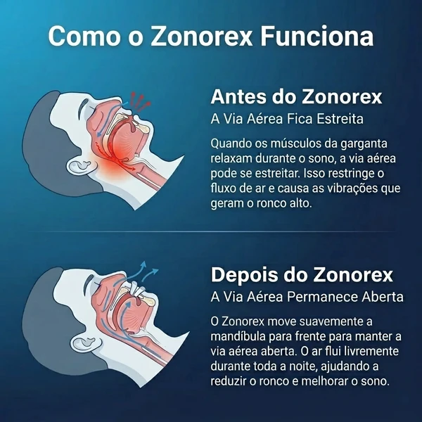 2 Unidades Zonorex  + Tapa Olhos e Protetor Auricular de Brinde + Frete Grátis 