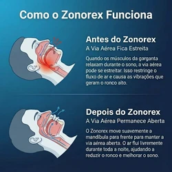 Zonorex — Protetor Bucal Anti-Ronco + Tapa Olho de Brinde + Frete Grátis